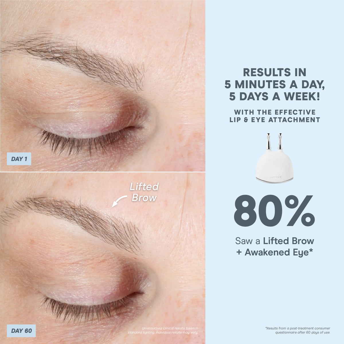 Sculpted For The Season - Ultimate Facial Device Kit