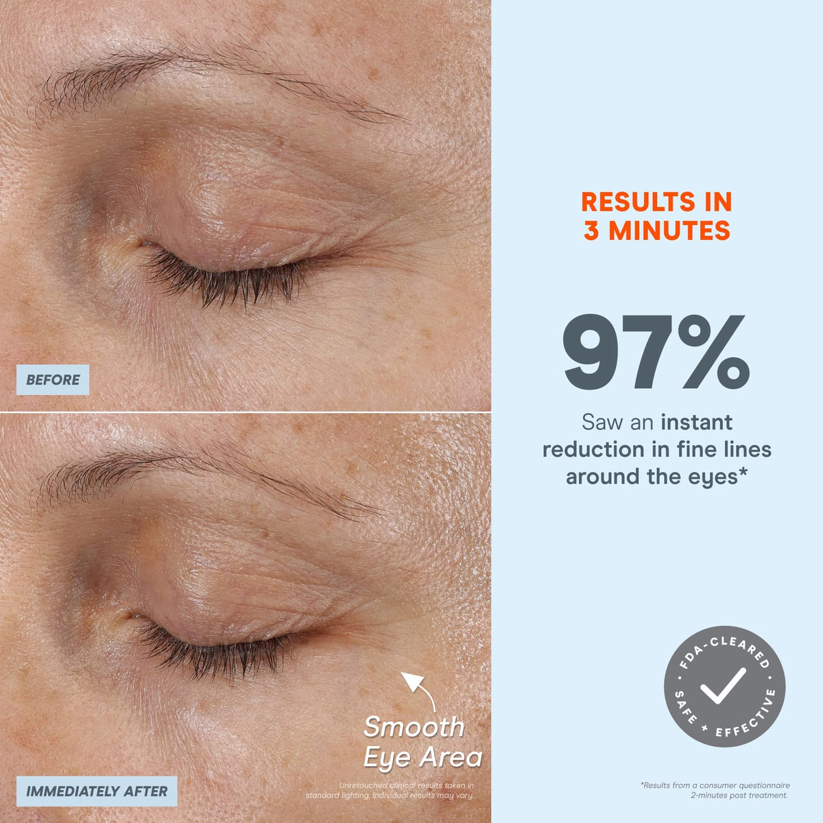 FIX MicroWand - Microcurrent Device for Eyes, Lips & Lines