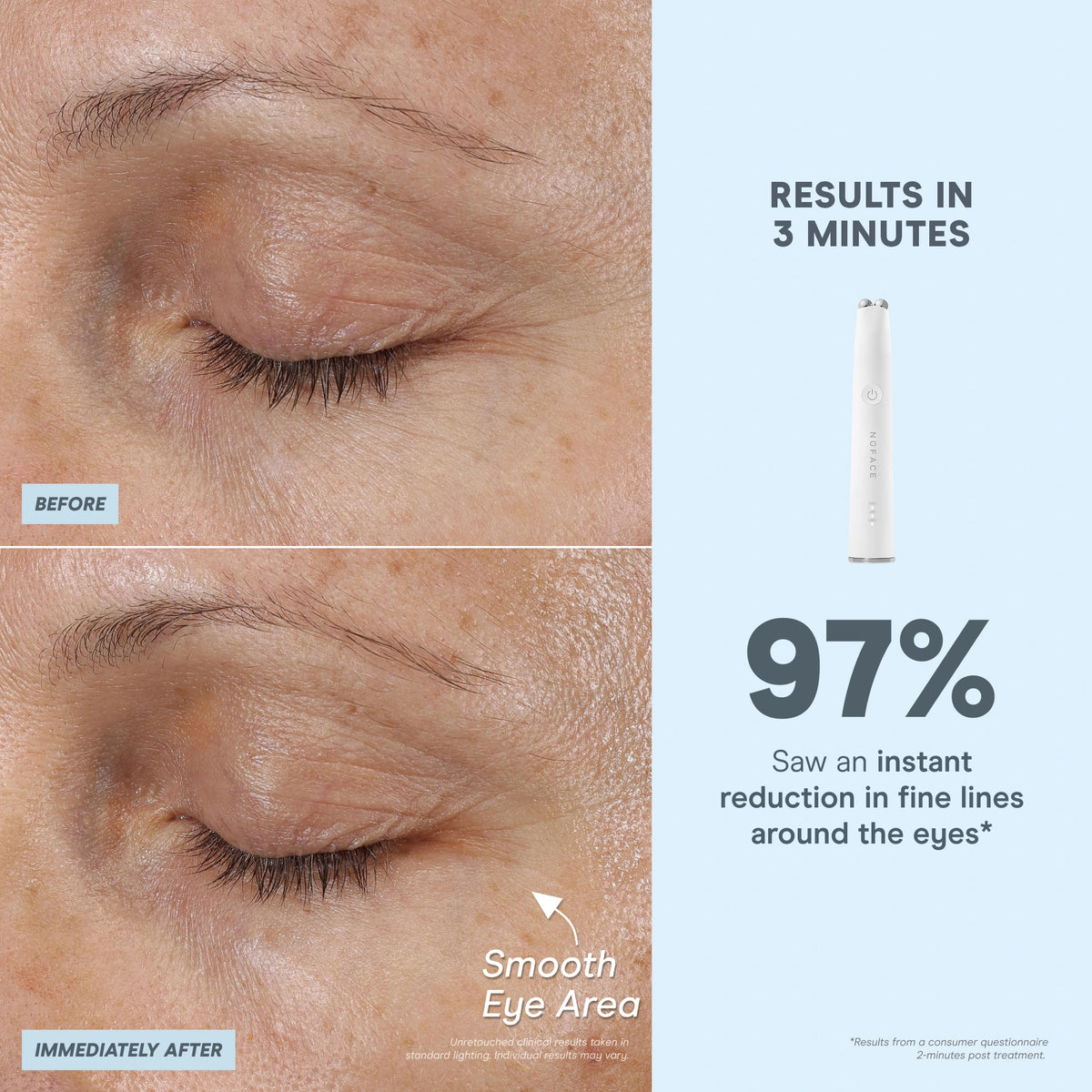 Sculpted For The Season - Ultimate Facial Device Kit